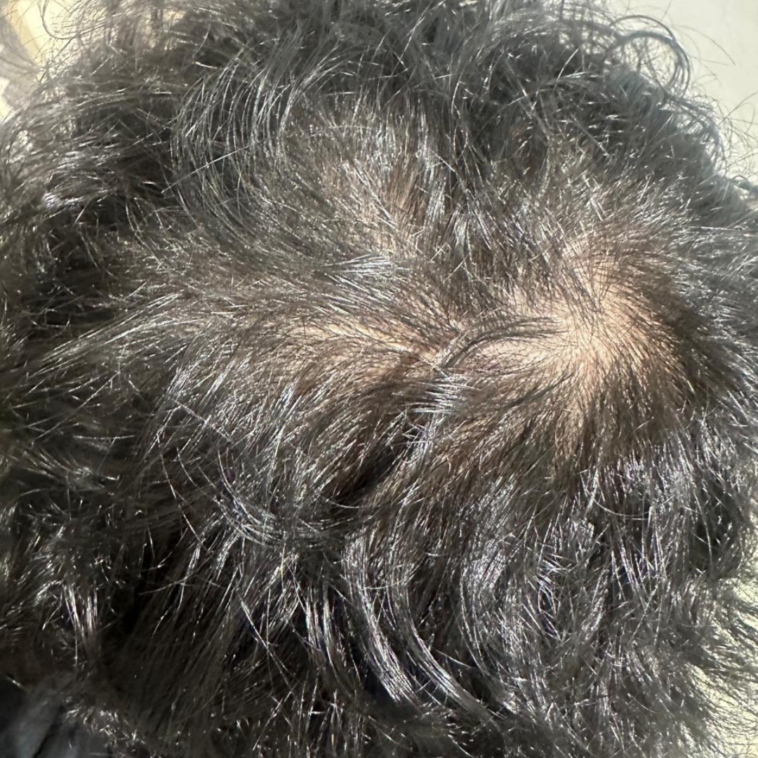 Before